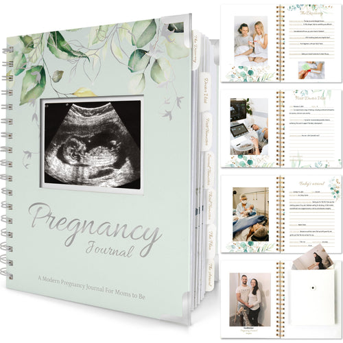 Pregnancy Journal for First Time Moms Gifts - 90 Pages Hardcover Pregnancy Memory Book, Beautiful & Cute Baby Book Keepsake, Ultrasound Baby Scrapbook, Mom To Be Gift (Alpine)